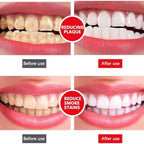 Yayashi Sp-4 Ultra Whitening Toothpaste Probiotic Stain Remover 100ml / Stain Removing Toothpaste, Protects Gums Freshens Breath, for Everyone