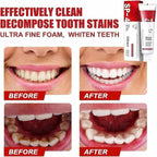 Yayashi Sp-4 Ultra Whitening Toothpaste Probiotic Stain Remover Stain Removing Toothpaste, Protects Gums Freshens Breath, for Everyone